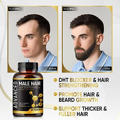 NutraPro Hair Growth Vitamins for Men - Anti Hair Loss Support with DHT Blocker & Biotin - 60 Count Avelisse