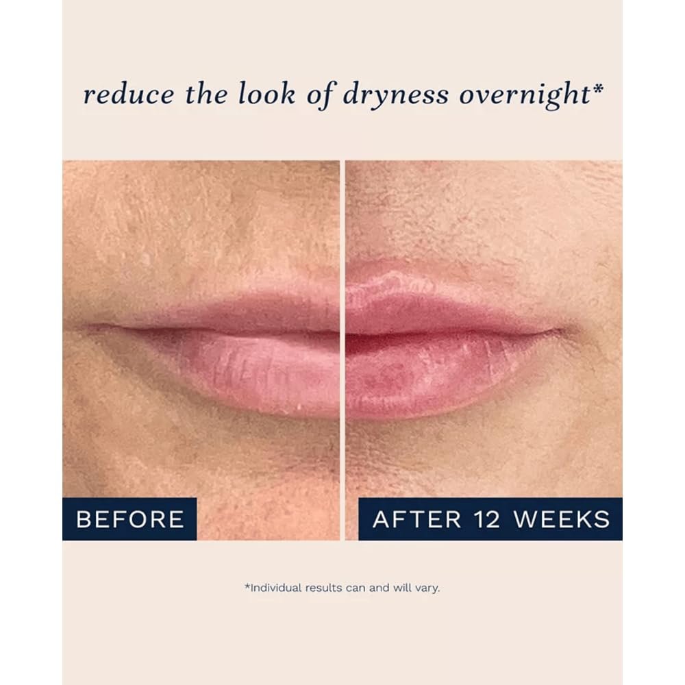 City Lips Night Oil - Overnight Lip Plumping & Hydrating Treatment with Hyaluronic Acid & Plant Extracts Avelisse