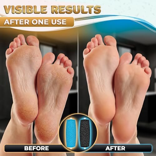 11 Pcs Replacement Rollers for Electric Foot Callus Remover - Extra Coarse & Regular Coarse Refill Heads for Pedi Perfect Pro - görsel 14