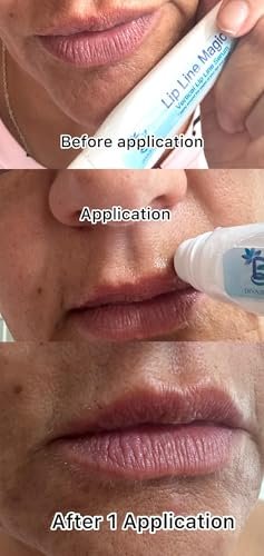 Lip Line Serum For Lines Above the Lips, Max Strength, With Hyaluronic Acid, Papaya Extract and Retinol Avelisse