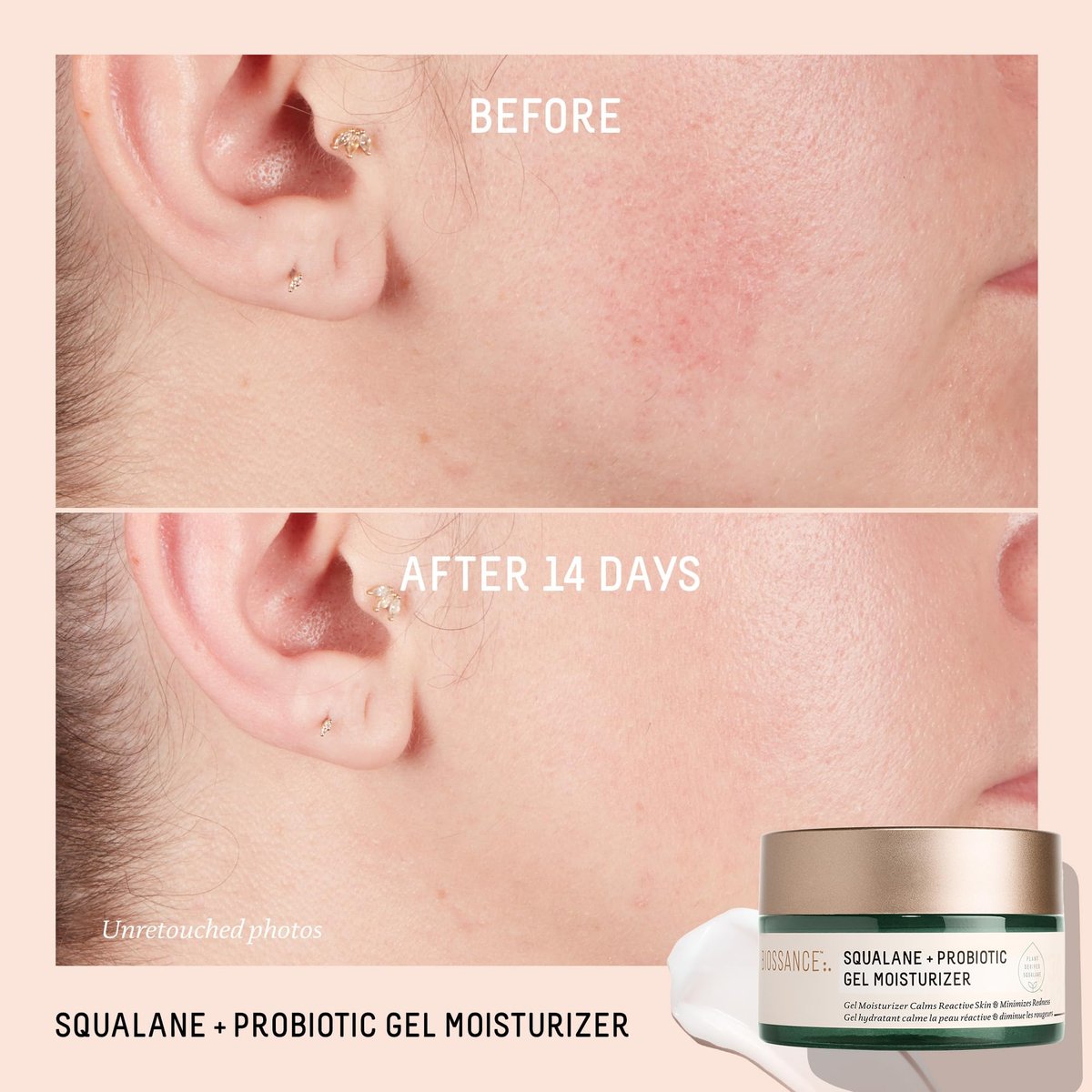 Biossance Squalane + Probiotic Balancing Face Gel Moisturizer - Advanced Formula for Oily & Acne-Prone Skin, 1.69 oz Avelisse