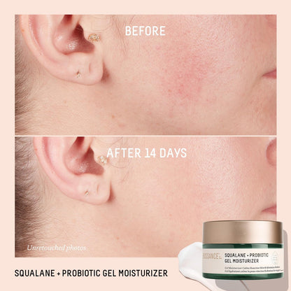 Biossance Squalane + Probiotic Balancing Face Gel Moisturizer - Advanced Formula for Oily & Acne-Prone Skin, 1.69 oz Avelisse