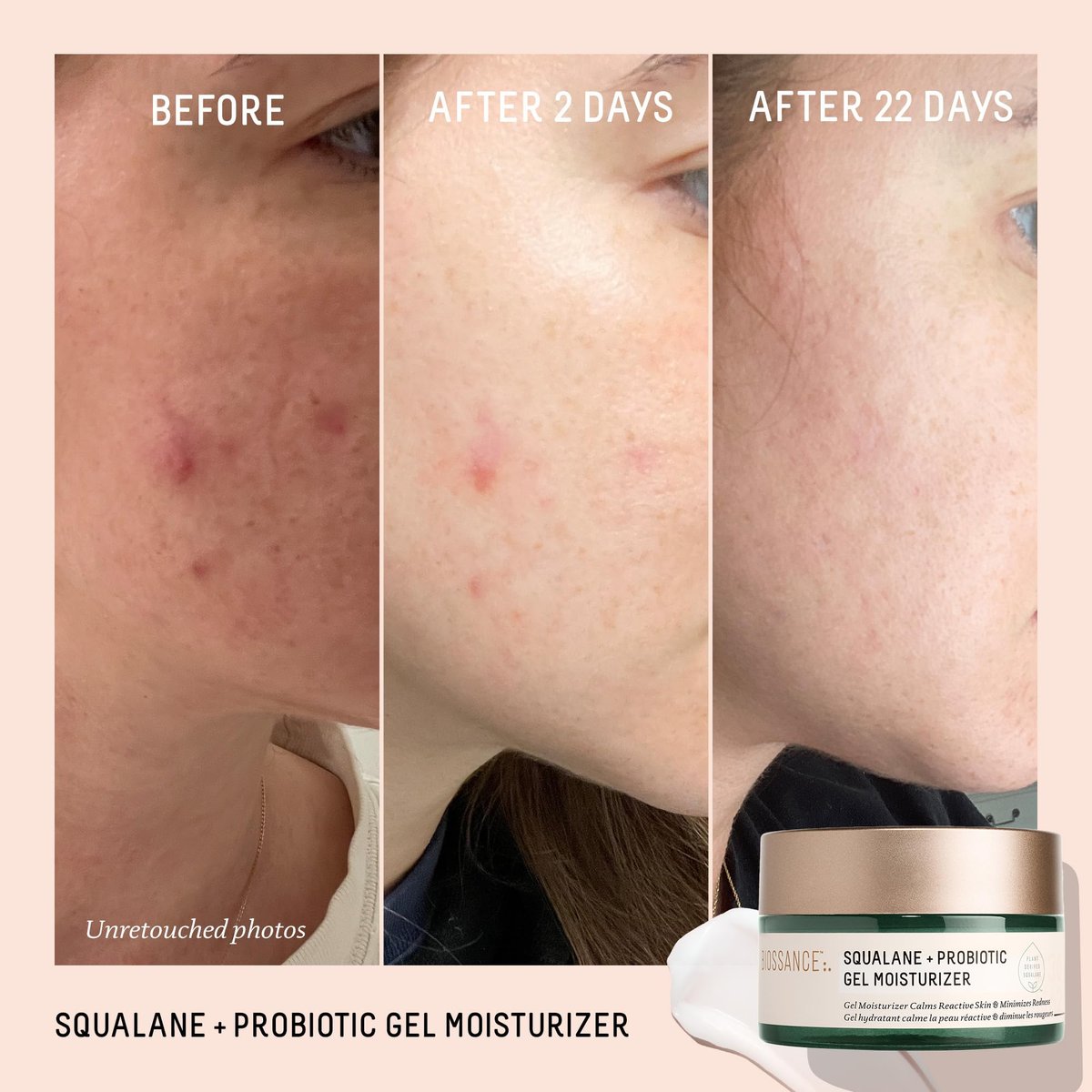 Biossance Squalane + Probiotic Balancing Face Gel Moisturizer - Advanced Formula for Oily & Acne-Prone Skin, 1.69 oz Avelisse