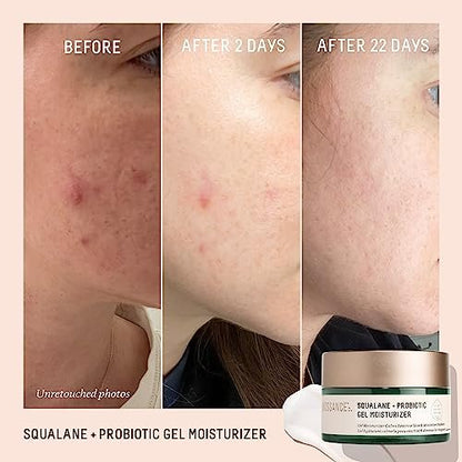 Biossance Squalane + Probiotic Balancing Face Gel Moisturizer - Advanced Formula for Oily & Acne-Prone Skin, 1.69 oz Avelisse