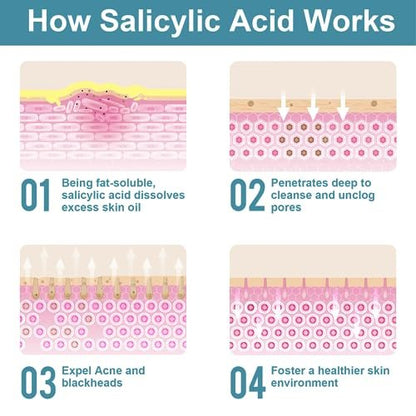 Salicylic Acid Powder (4.58 oz / 130 g) - Ultra Pure Cosmetic Grade BHA Exfoliant for DIY Skincare & Haircare