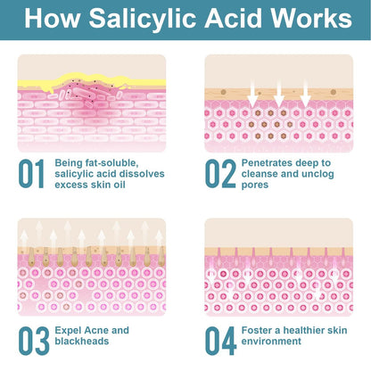 Salicylic Acid Powder (4.58 oz / 130 g) - Ultra Pure Cosmetic Grade BHA Exfoliant for DIY Skincare & Haircare