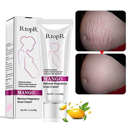 Mango Stretch Marks and Scar Cream - Effective Removal for Pregnancy, Wrinkles, Obesity Marks - Moisturizing Belly Cream (40g)