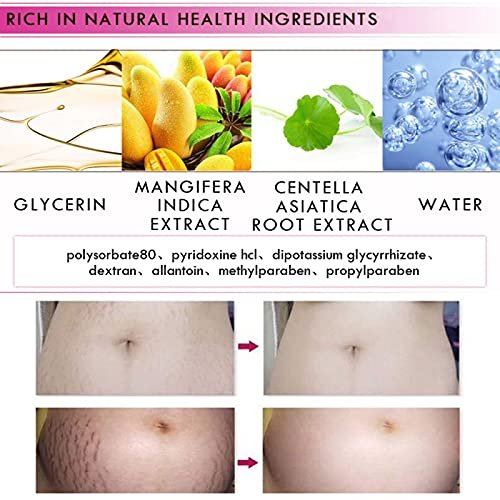 Mango Stretch Marks and Scar Cream - Effective Removal for Pregnancy, Wrinkles, Obesity Marks - Moisturizing Belly Cream (40g) - görsel 8