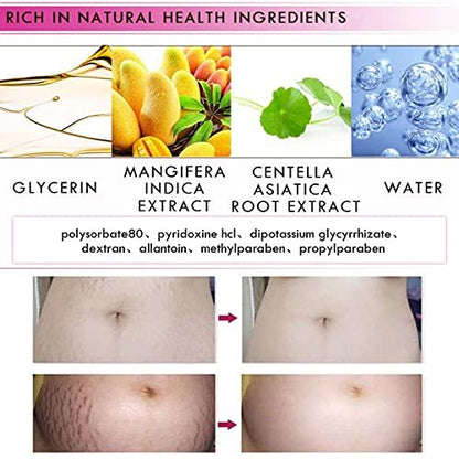 Mango Stretch Marks and Scar Cream - Effective Removal for Pregnancy, Wrinkles, Obesity Marks - Moisturizing Belly Cream (40g)