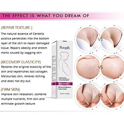 Mango Stretch Marks and Scar Cream - Effective Removal for Pregnancy, Wrinkles, Obesity Marks - Moisturizing Belly Cream (40g)