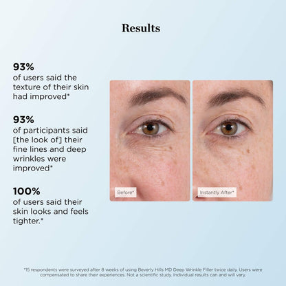 Beverly Hills MD Deep Wrinkle Filler - Instant Anti-Aging Serum with Diamond Dust & Polymers for Fine Lines & Deep Creases Avelisse