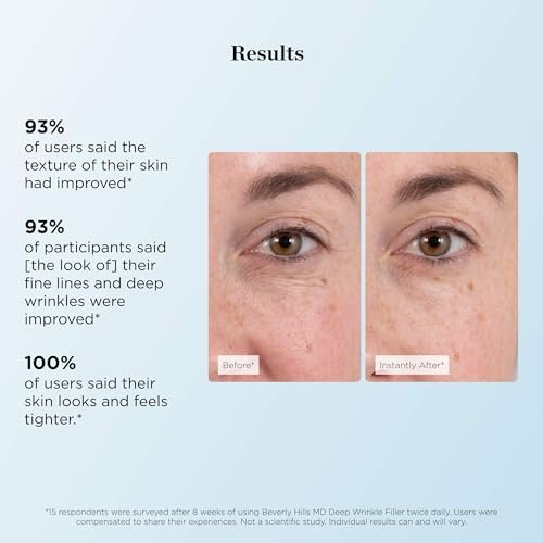 Beverly Hills MD Deep Wrinkle Filler - Instant Anti-Aging Serum with Diamond Dust & Polymers for Fine Lines & Deep Creases Avelisse