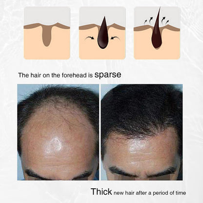 Rosemary, Onion and Black Seed 3-in-1 Hair Growth Spray - Controls Loss and Promotes Growth for Men and Women