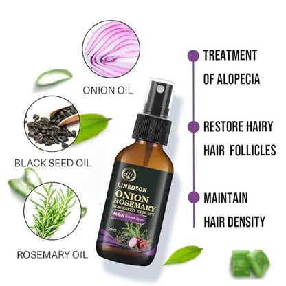 Rosemary, Onion and Black Seed 3-in-1 Hair Growth Spray - Controls Loss and Promotes Growth for Men and Women