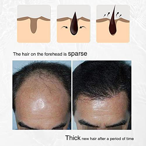 Rosemary, Onion and Black Seed 3-in-1 Hair Growth Spray - Controls Loss and Promotes Growth for Men and Women - görsel 9