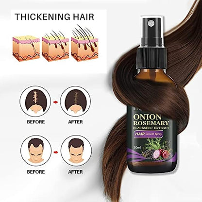 Rosemary, Onion and Black Seed 3-in-1 Hair Growth Spray - Controls Loss and Promotes Growth for Men and Women