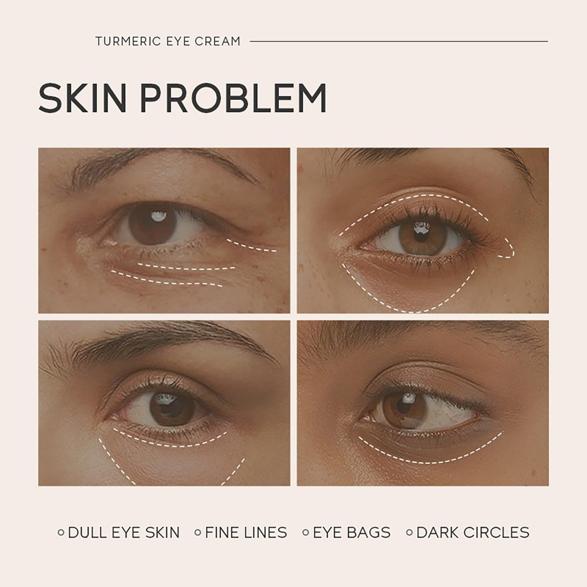 Easilydays Turmeric Under Eye Cream – Hydrating Eye Serum for Dark Circles, Fine Lines, and Puffiness Avelisse