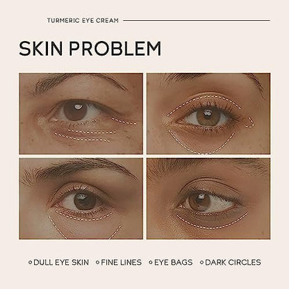 Easilydays Turmeric Under Eye Cream – Hydrating Eye Serum for Dark Circles, Fine Lines, and Puffiness Avelisse