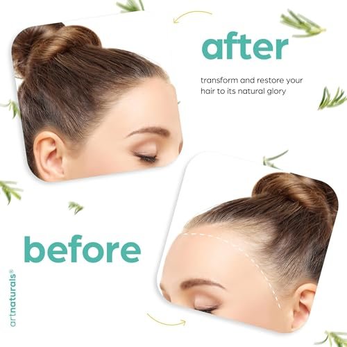 Artnaturals Organic Rosemary Castor Hair Oil + Massager Set for Hair Growth – 4 oz with Coconut & Olive Oil, for Dry, Damaged & Split Ends Avelisse