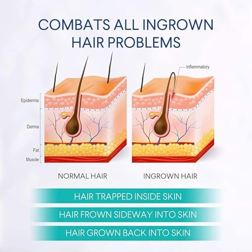 Razor Bumps Treatment for Women and Men - Ingrown Hair Serum for Face, Neck, Bikini Area, Legs, and Underarms - After Shave Solution for All Skin Types - 3.5 oz Avelisse