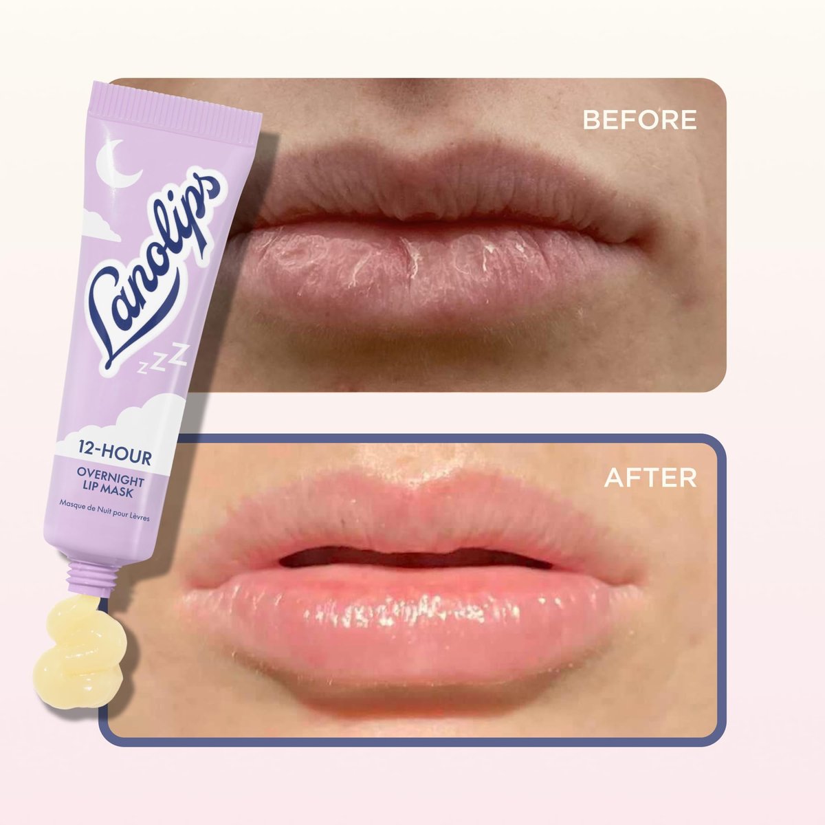 Lanolips 12 Hour Overnight Lip Mask – Rich Lanolin Lip Balm with Hyaluronic Acid, Vitamin C & Ceramides – Restore, Soften & Replenish While You Sleep – Cruelty-Free Hydrating Balm (0.52 oz / 15 g) - görsel 11