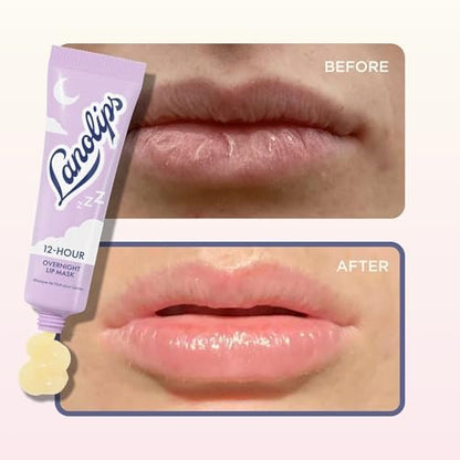 Lanolips 12 Hour Overnight Lip Mask – Rich Lanolin Lip Balm with Hyaluronic Acid, Vitamin C & Ceramides – Restore, Soften & Replenish While You Sleep – Cruelty-Free Hydrating Balm (0.52 oz / 15 g)
