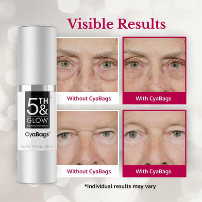 5th & Glow Cyabags Instant Under Eye Bag Remover Serum – Puffy Eyes Reduction with Hyaluronic Acid & Vitamin C for Fine Lines, Wrinkles & Crow's Feet, 1 oz Avelisse