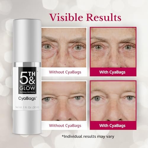 5th & Glow Cyabags Instant Under Eye Bag Remover Serum – Puffy Eyes Reduction with Hyaluronic Acid & Vitamin C for Fine Lines, Wrinkles & Crow's Feet, 1 oz Avelisse