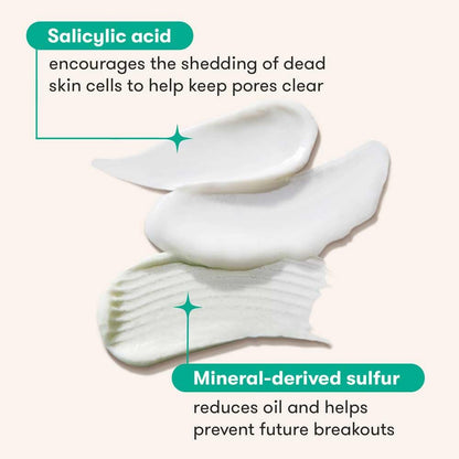 Proactiv Clean 3-Step Acne Routine with Pimple Patches – Sulfur Cleanser, Azelaic Acid Serum & Moisturizer for Sensitive Acne-Prone Skin – 30-Day Kit Avelisse