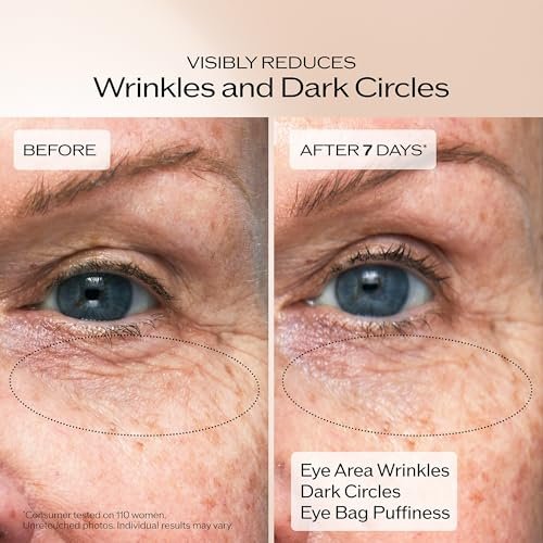 Shiseido Benefiance Wrinkle Smoothing Eye Cream – 15 mL – Visibly Improves Five Types of Eye Wrinkles, Dark Circles & Puffiness – 48-Hour Hydration – All Skin Types – Non-Comedogenic Avelisse