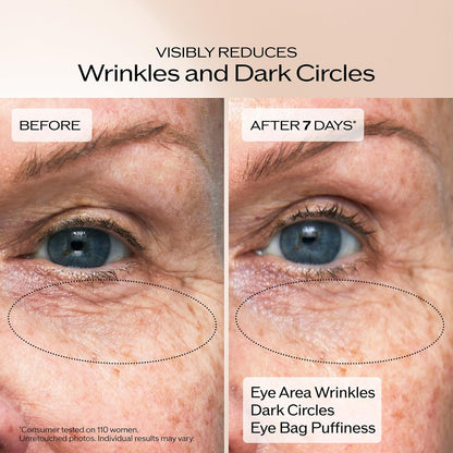 Shiseido Benefiance Wrinkle Smoothing Eye Cream – 15 mL – Visibly Improves Five Types of Eye Wrinkles, Dark Circles & Puffiness – 48-Hour Hydration – All Skin Types – Non-Comedogenic Avelisse