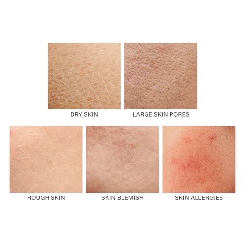 YAFUSIPE Strawberry Legs Treatment - Niacinamide Resurfacing Cream for Keratosis Pilaris, Hydrating Body Moisturizer for Women & Men, 4.2 Fl Oz Avelisse