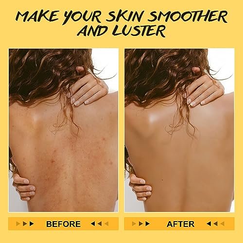 POP MODERN.C Turmeric and Vitamin C Body Scrub – Natural Organic Exfoliator for Dark Spots, Acne, and Dead Skin Removal with Loofah (10.58 oz) - görsel 7
