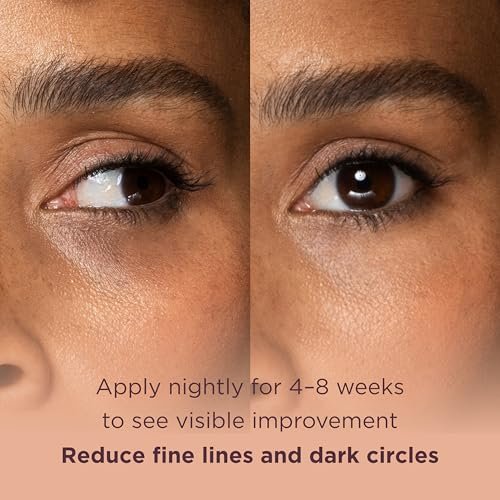 MATKAS Korean Retinol Under Eye Cream for Dark Circles & Puffiness - Brightening Anti-Aging Eye Serum, 0.5 fl.oz. - görsel 12