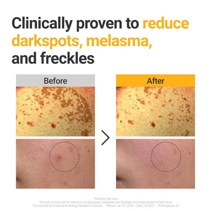 ROVECTIN Vita Dark Spot Correcting Serum – Brightening Vitamin C & Niacinamide Serum for Glowing, Even Skin Tone | Vegan & Gentle Formula for Sensitive Skin Avelisse