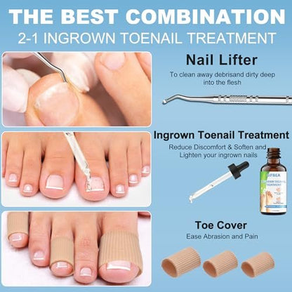 Ingrown Toenail Treatment with Softener & Reliever Drops, Double Sided Pedicure Nail Lifter Tool for Easy Trimming – Toenail Cleaner Kit for Men & Women
