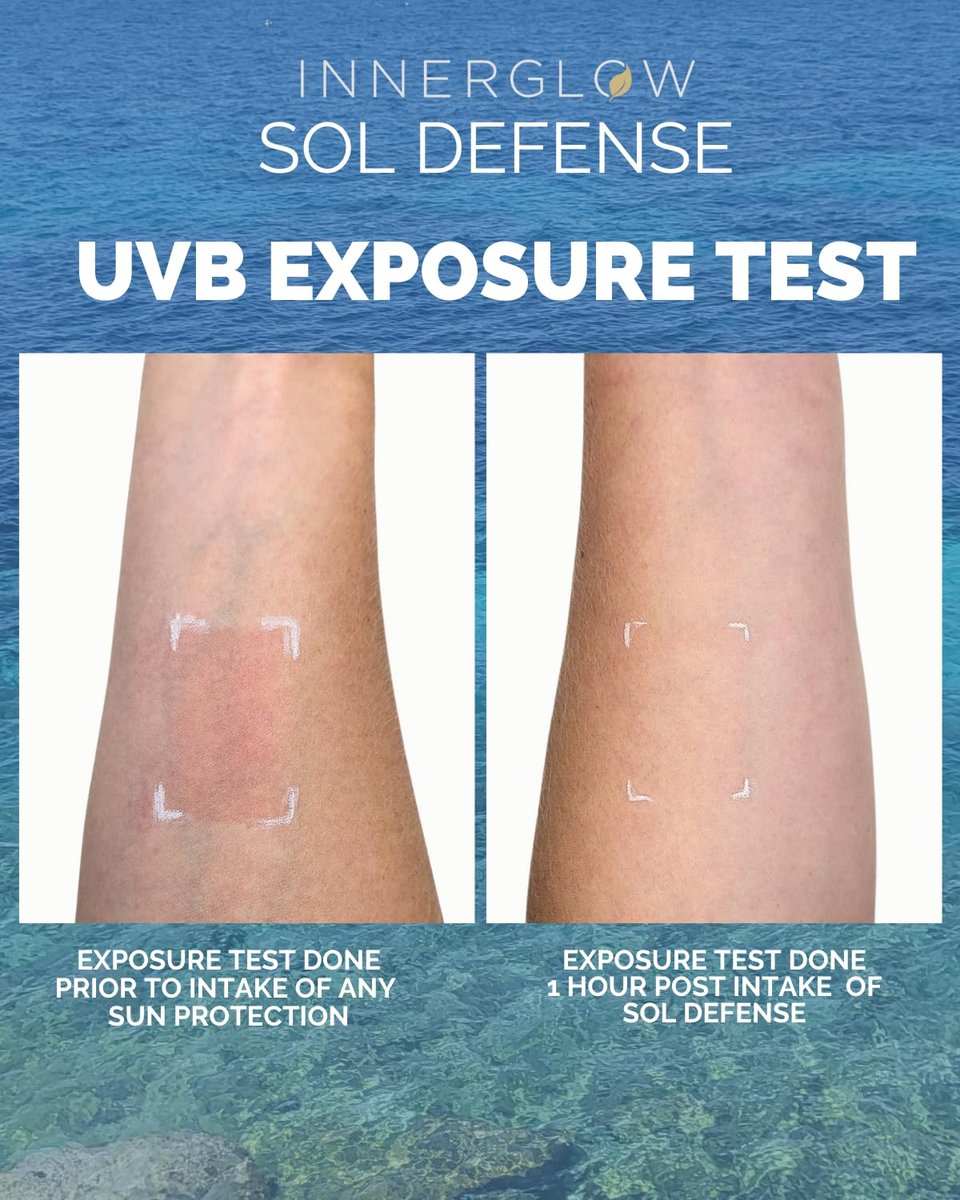 Inner Glow Sol Defense Gummies – Dermatologist & Plastic Surgeon-Formulated Skin Resilience Vitamin Supplement with Polypodium Leucotomos & Niacinamide, Passion Fruit Flavor, 60 Sugar-Free Gummies Avelisse