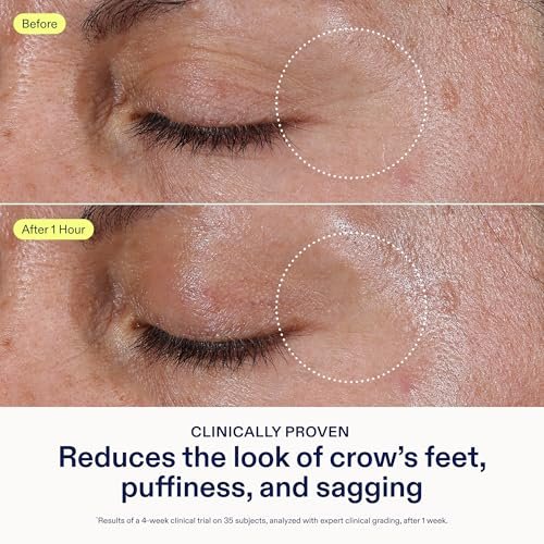 Skinfix Triple Lipid Eye Treatment - 0.5 fl oz - Eye Cream - Visibly Tightens, Depuffs & Smooths Undereyes - Non-Comedogenic - Fragrance Free - Vegan, Cruelty Free Avelisse