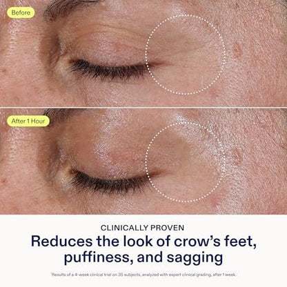 Skinfix Triple Lipid Eye Treatment - 0.5 fl oz - Eye Cream - Visibly Tightens, Depuffs & Smooths Undereyes - Non-Comedogenic - Fragrance Free - Vegan, Cruelty Free Avelisse