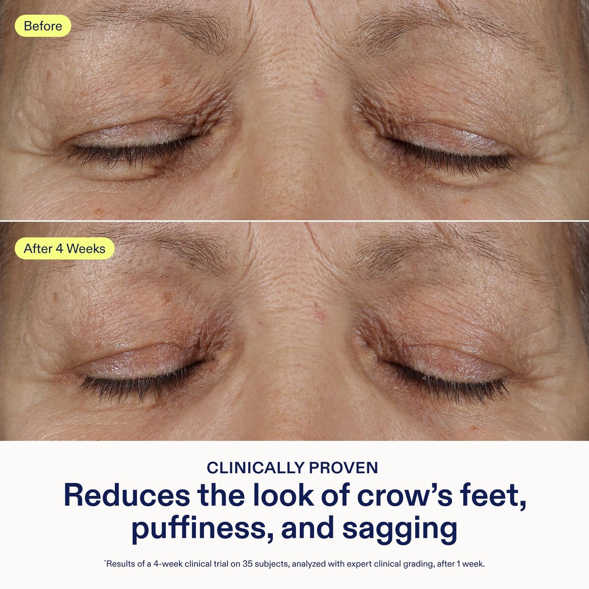 Skinfix Triple Lipid Eye Treatment - 0.5 fl oz - Eye Cream - Visibly Tightens, Depuffs & Smooths Undereyes - Non-Comedogenic - Fragrance Free - Vegan, Cruelty Free Avelisse