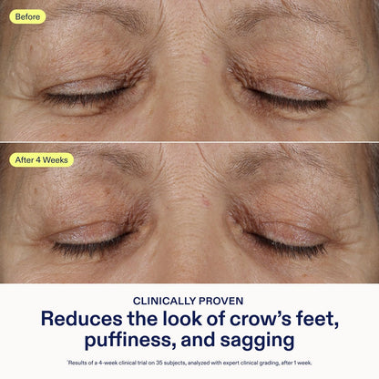 Skinfix Triple Lipid Eye Treatment - 0.5 fl oz - Eye Cream - Visibly Tightens, Depuffs & Smooths Undereyes - Non-Comedogenic - Fragrance Free - Vegan, Cruelty Free Avelisse