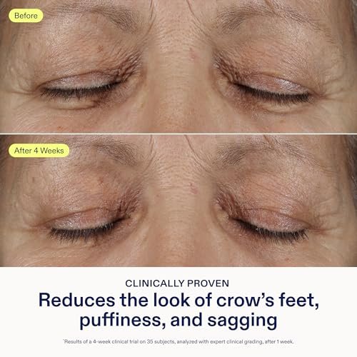 Skinfix Triple Lipid Eye Treatment - 0.5 fl oz - Eye Cream - Visibly Tightens, Depuffs & Smooths Undereyes - Non-Comedogenic - Fragrance Free - Vegan, Cruelty Free Avelisse