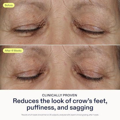 Skinfix Triple Lipid Eye Treatment - 0.5 fl oz - Eye Cream - Visibly Tightens, Depuffs & Smooths Undereyes - Non-Comedogenic - Fragrance Free - Vegan, Cruelty Free Avelisse