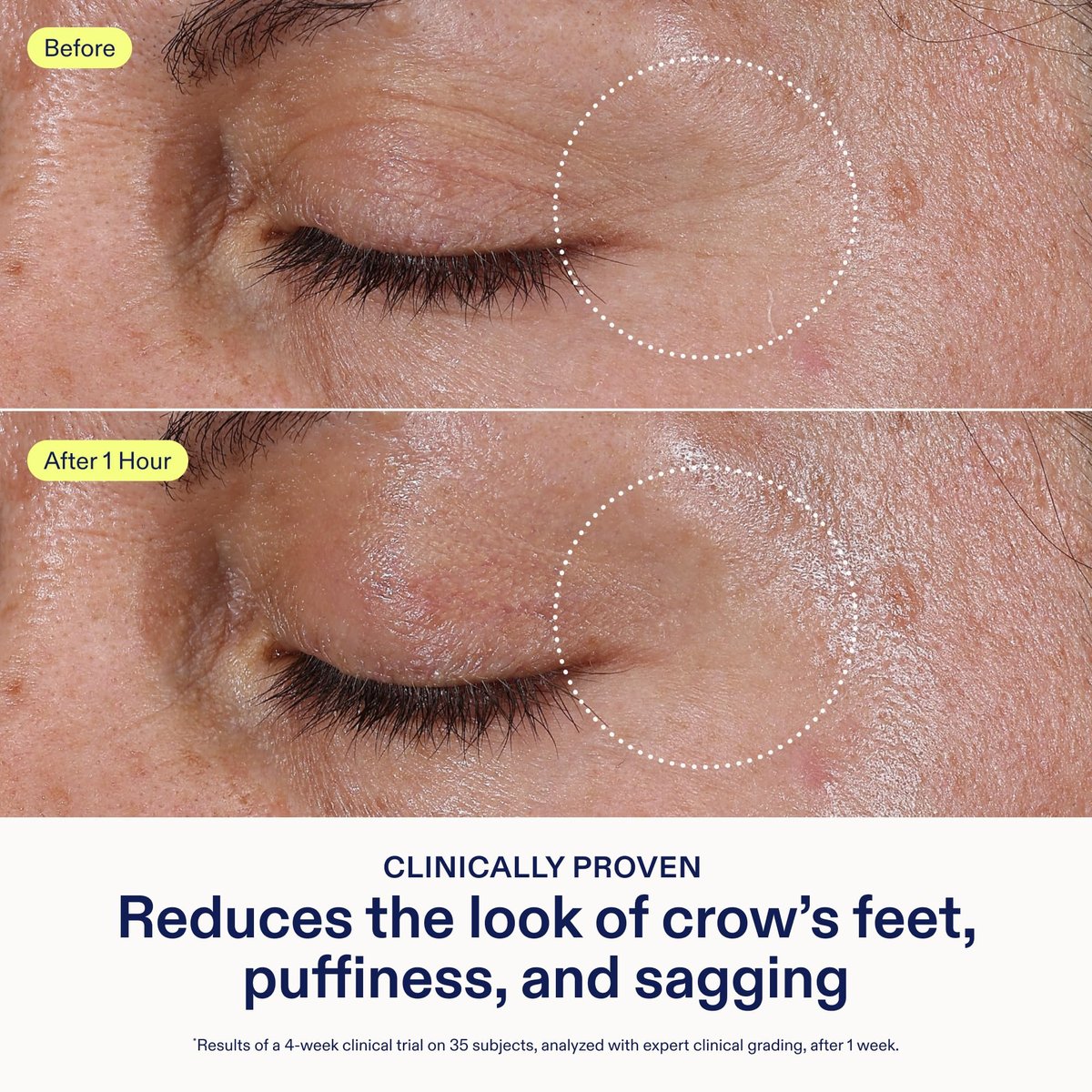 Skinfix Triple Lipid Eye Treatment - 0.5 fl oz - Eye Cream - Visibly Tightens, Depuffs & Smooths Undereyes - Non-Comedogenic - Fragrance Free - Vegan, Cruelty Free Avelisse