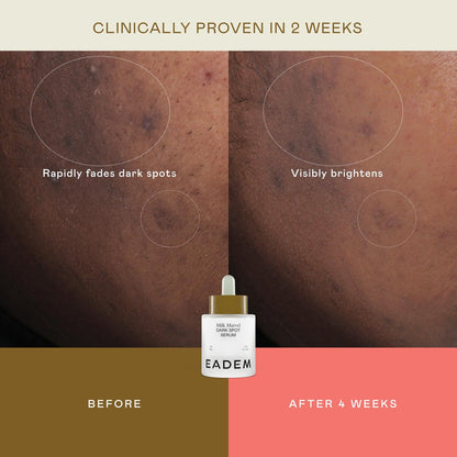 EADEM Milk Marvel Dark Spot Serum – Vitamin C & Niacinamide Face Serum for Dark Spot Removal, Natural Skin Care, 1 oz Avelisse