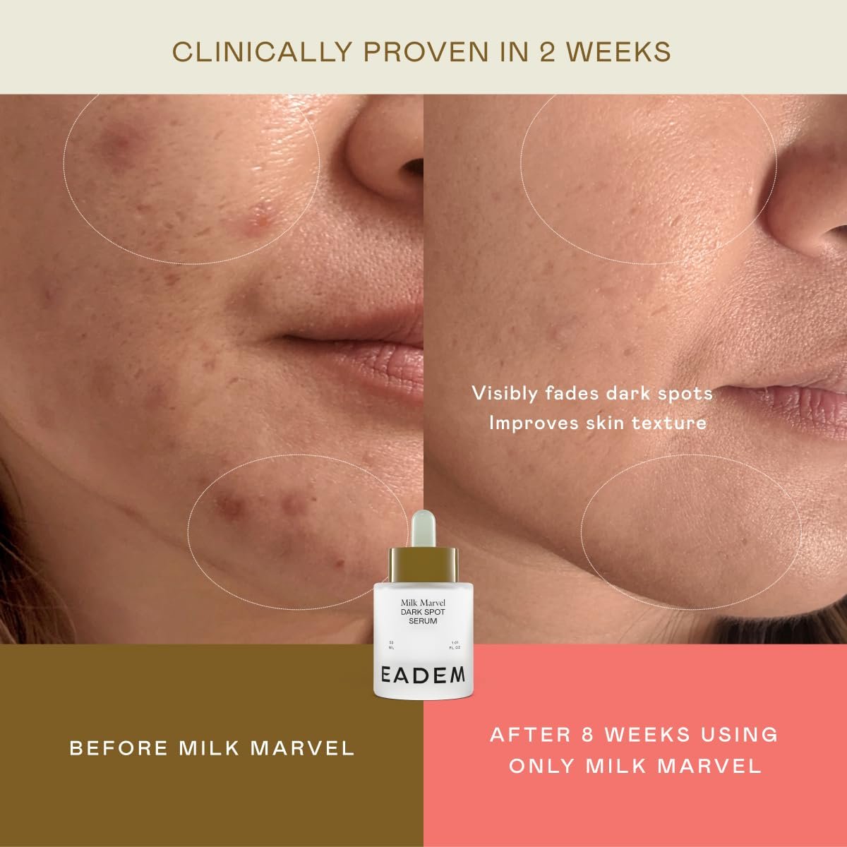 EADEM Milk Marvel Dark Spot Serum – Vitamin C & Niacinamide Face Serum for Dark Spot Removal, Natural Skin Care, 1 oz Avelisse