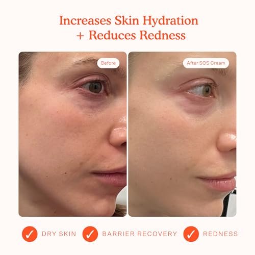 Tower 28 SOS Recovery Face Cream - Hydrating Moisturizer with Hyaluronic Acid & Ceramides for Sensitive Skin - Barrier Repair, Reduces Redness & Improves Texture, 1.86 oz Avelisse