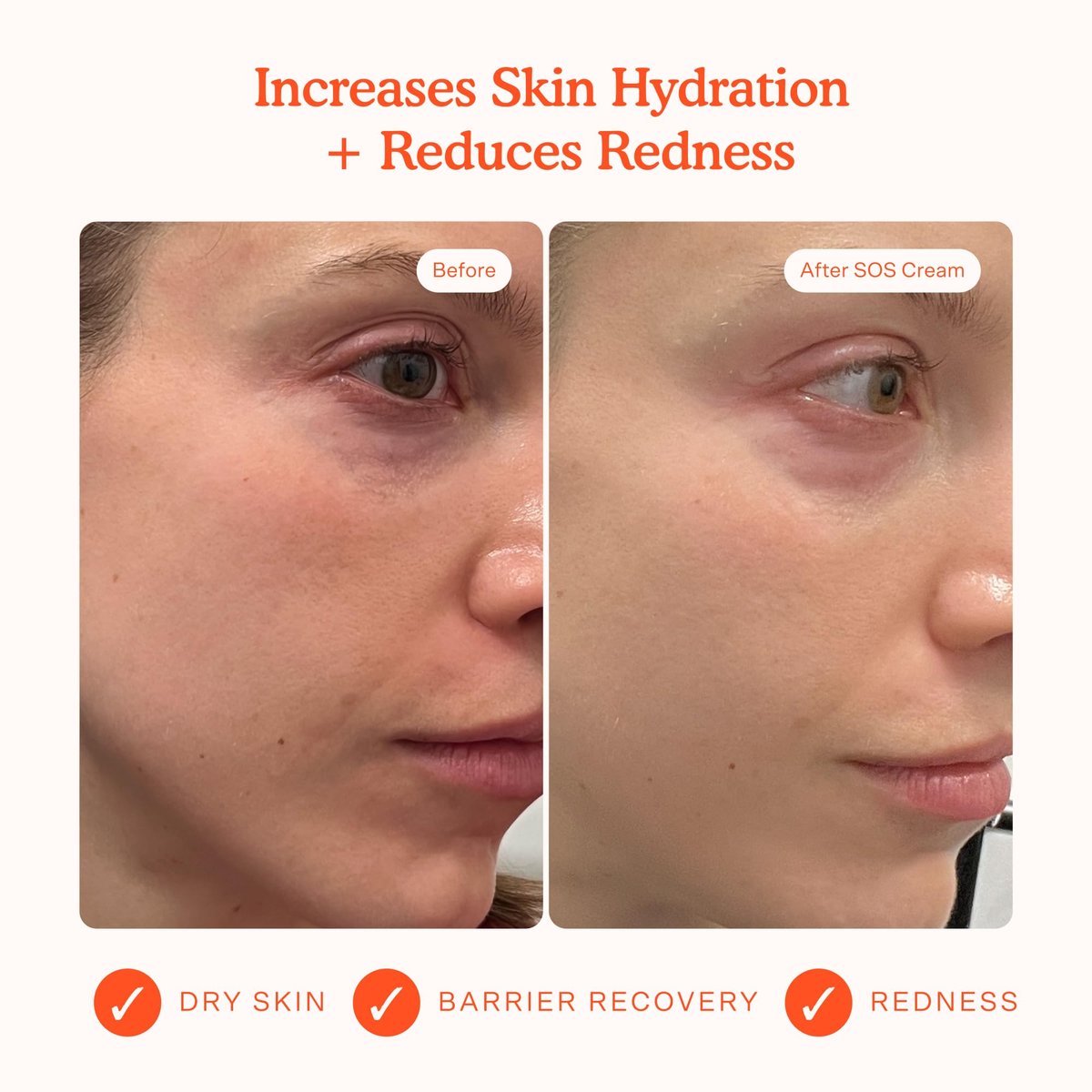 Tower 28 SOS Recovery Face Cream - Hydrating Moisturizer with Hyaluronic Acid & Ceramides for Sensitive Skin - Barrier Repair, Reduces Redness & Improves Texture, 1.86 oz Avelisse