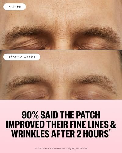 PEACE OUT Microneedling Wrinkle Patches with Retinol, Peptides & Vitamin C - 6 Count Avelisse