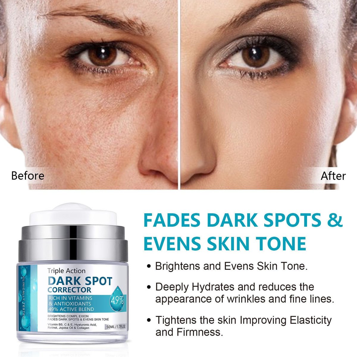 LAIKME Dark Spot Remover for Face and Body - Dark Spot Corrector Cream for Age Spots, Melasma, Freckles, Sun Spots & Blemishes for Women and Men - görsel 5